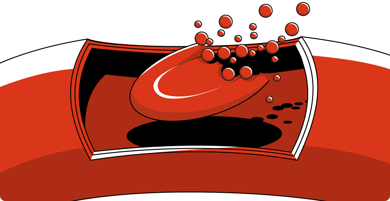 Keep showing PNH red blood cell